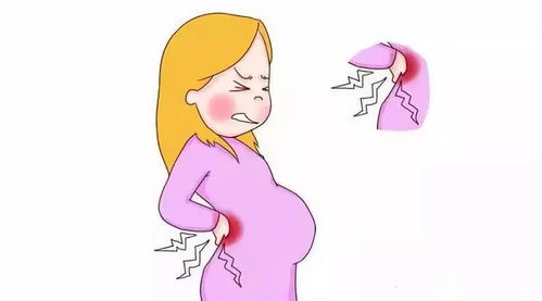 孕妇怎么按摩腰部缓解疼痛