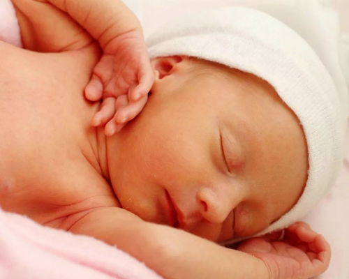 新生儿黄疸护理问题护理目标护理措施