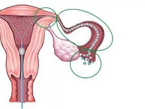 输卵管的通畅度检查