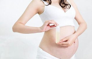 孕妇的皮肤护理