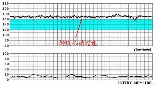 胎动监护怎么才算正常的