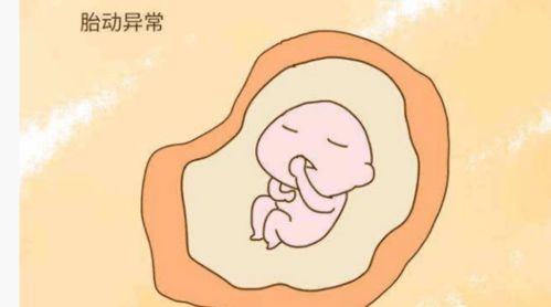 孕期怎么预防早产儿缺氧