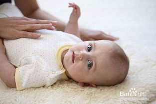新生儿黄疸的预防和护理