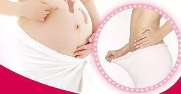 剖腹产孕妇护理措施