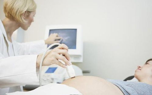 怀孕期间工作安排不合理导致胎儿流产